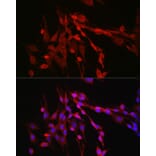 Immunofluorescence - Anti-Inhibin beta A Antibody (A15007) - Antibodies.com