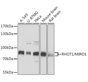 Western Blot - Anti-MIRO1 Antibody (A15008) - Antibodies.com