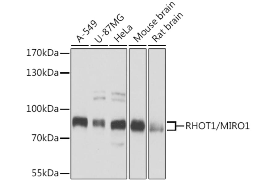 Western Blot - Anti-MIRO1 Antibody (A15008) - Antibodies.com