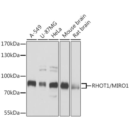 Western Blot - Anti-MIRO1 Antibody (A15008) - Antibodies.com