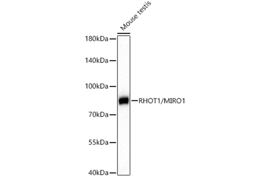 Western Blot - Anti-MIRO1 Antibody (A15008) - Antibodies.com