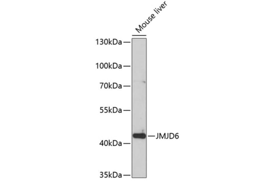 Western Blot - Anti-JMJD6 Antibody (A5840) - Antibodies.com