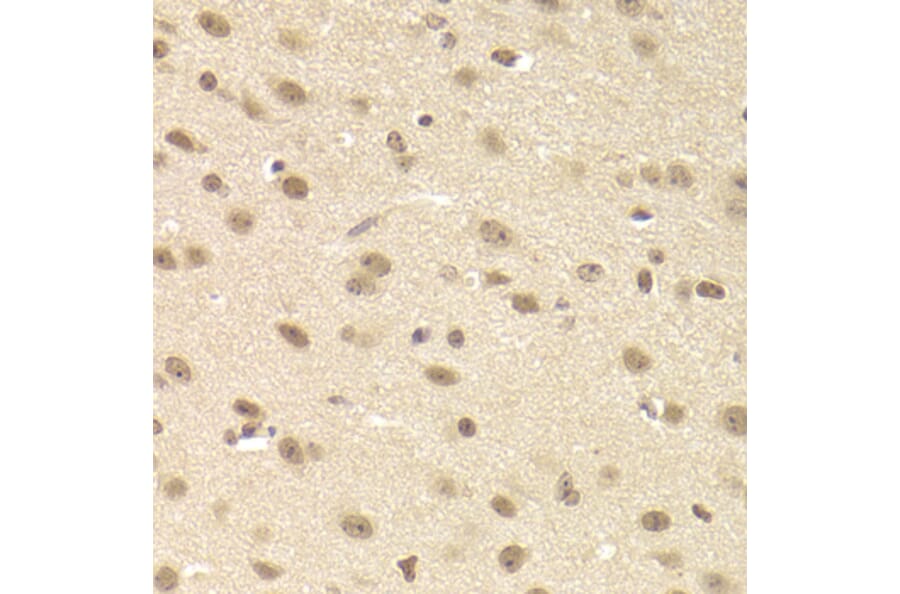 Immunohistochemistry - Anti-JMJD6 Antibody (A5840) - Antibodies.com