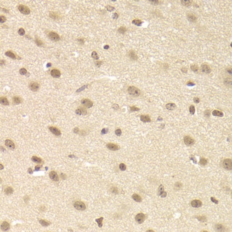 Immunohistochemistry - Anti-JMJD6 Antibody (A5840) - Antibodies.com