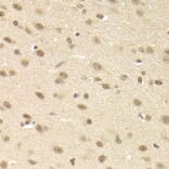 Immunohistochemistry - Anti-JMJD6 Antibody (A5840) - Antibodies.com