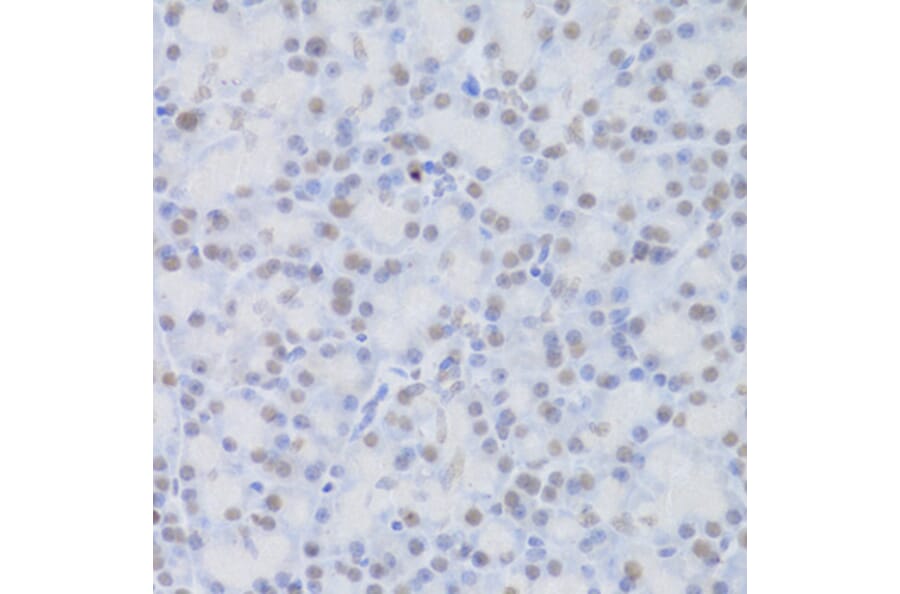Immunohistochemistry - Anti-JMJD6 Antibody (A5840) - Antibodies.com