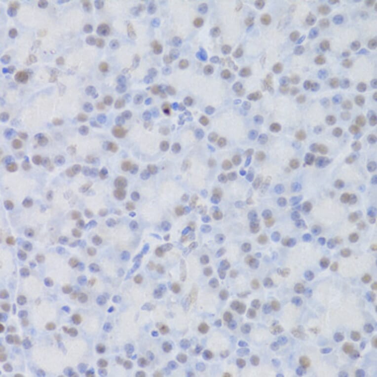 Immunohistochemistry - Anti-JMJD6 Antibody (A5840) - Antibodies.com