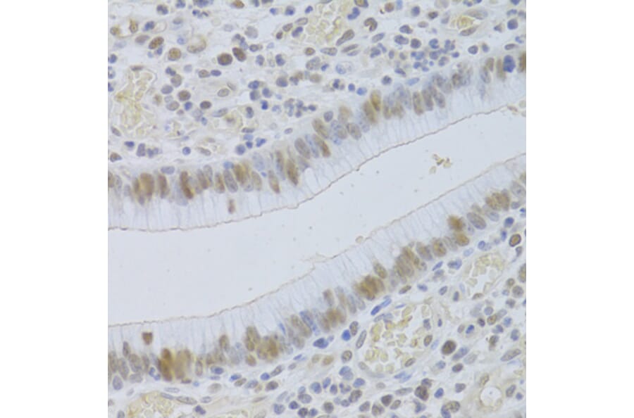 Immunohistochemistry - Anti-JMJD6 Antibody (A5840) - Antibodies.com