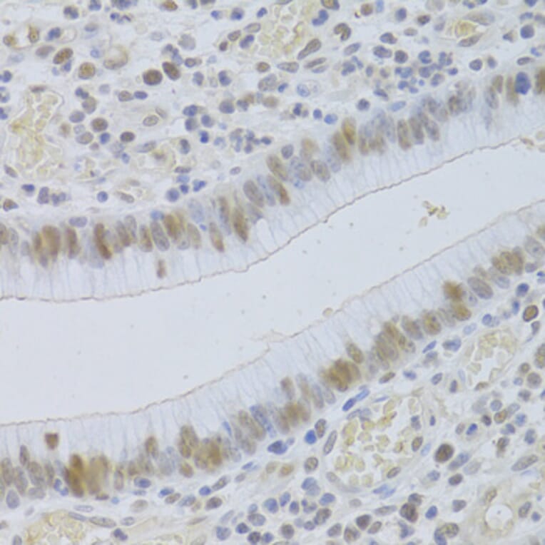 Immunohistochemistry - Anti-JMJD6 Antibody (A5840) - Antibodies.com