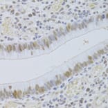 Immunohistochemistry - Anti-JMJD6 Antibody (A5840) - Antibodies.com