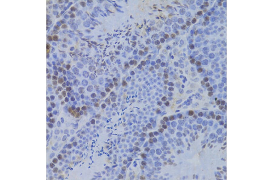Immunohistochemistry - Anti-JMJD6 Antibody (A5840) - Antibodies.com