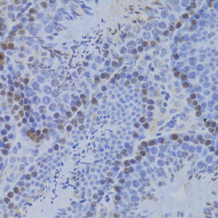 Immunohistochemistry - Anti-JMJD6 Antibody (A5840) - Antibodies.com
