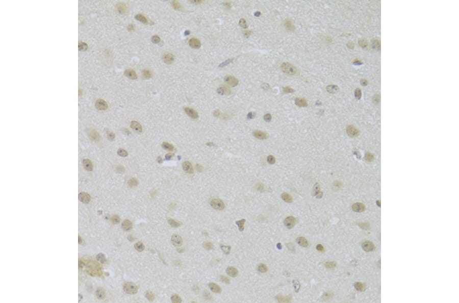 Immunohistochemistry - Anti-JMJD6 Antibody (A5840) - Antibodies.com