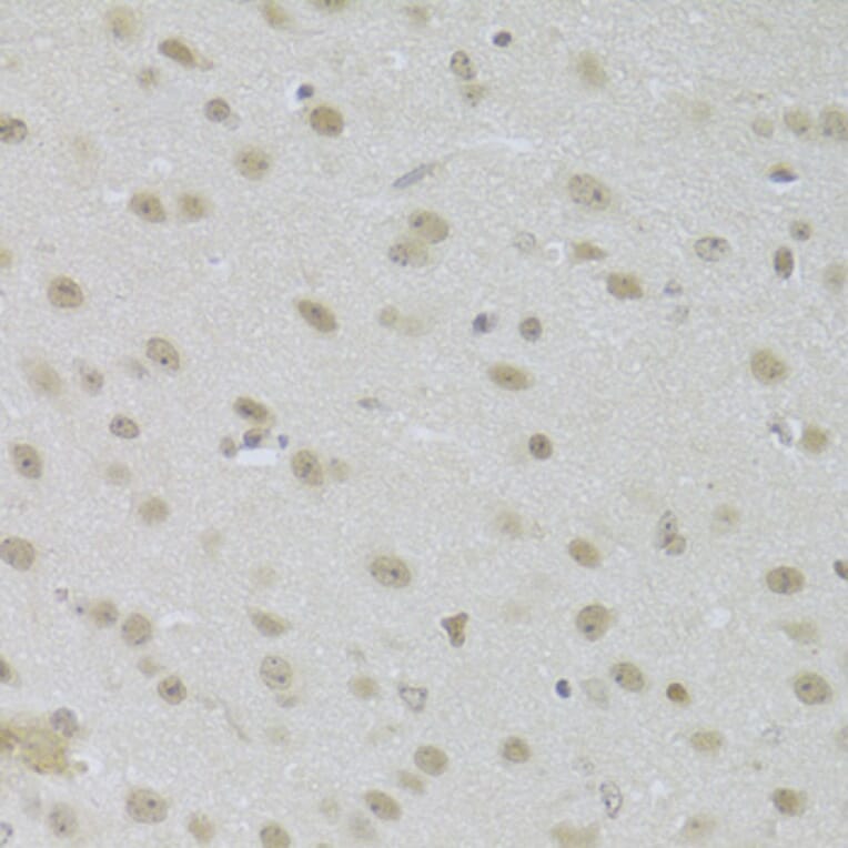 Immunohistochemistry - Anti-JMJD6 Antibody (A5840) - Antibodies.com