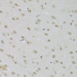 Immunohistochemistry - Anti-JMJD6 Antibody (A5840) - Antibodies.com
