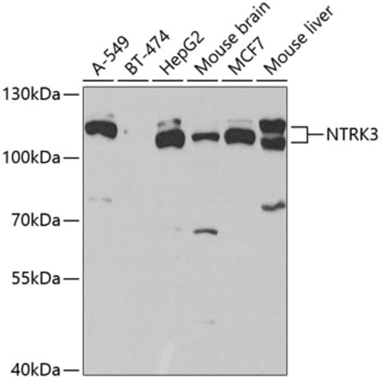 Western Blot - Anti-TrkC Antibody (A15010) - Antibodies.com