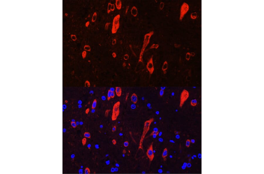 Immunofluorescence - Anti-TrkC Antibody (A15010) - Antibodies.com