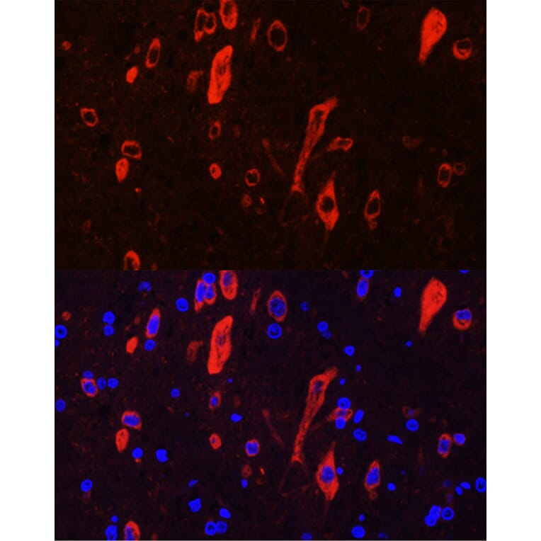 Immunofluorescence - Anti-TrkC Antibody (A15010) - Antibodies.com