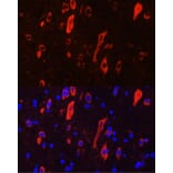 Immunofluorescence - Anti-TrkC Antibody (A15010) - Antibodies.com