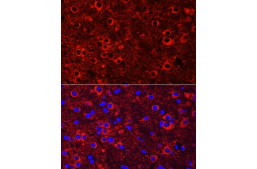 Immunofluorescence - Anti-TrkC Antibody (A15010) - Antibodies.com