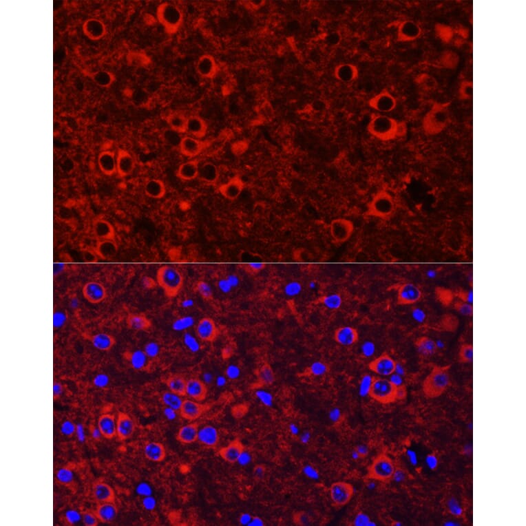 Immunofluorescence - Anti-TrkC Antibody (A15010) - Antibodies.com