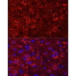 Immunofluorescence - Anti-TrkC Antibody (A15010) - Antibodies.com