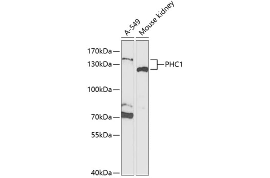 Western Blot - Anti-EDR1/PHC1 Antibody (A15011) - Antibodies.com