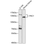 Western Blot - Anti-EDR1/PHC1 Antibody (A15011) - Antibodies.com