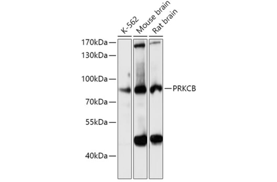 Western Blot - Anti-PKC beta Antibody (A15012) - Antibodies.com