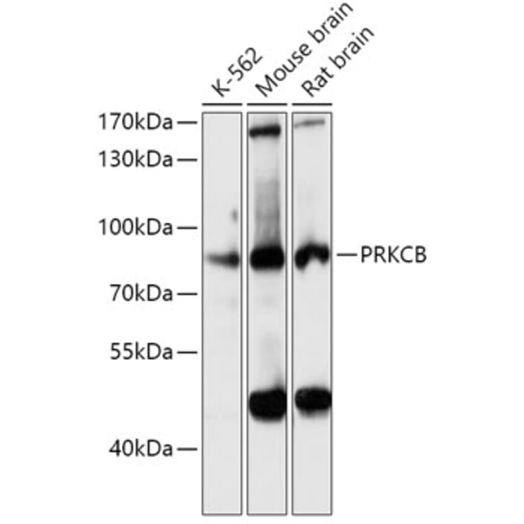 Western Blot - Anti-PKC beta Antibody (A15012) - Antibodies.com