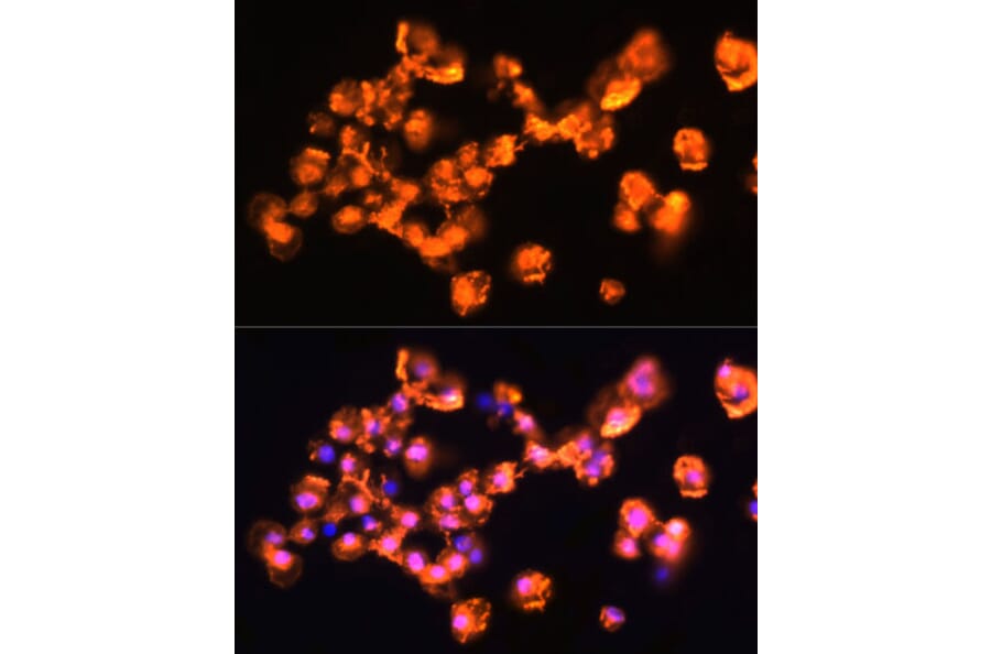 Immunofluorescence - Anti-PKC beta Antibody (A15012) - Antibodies.com