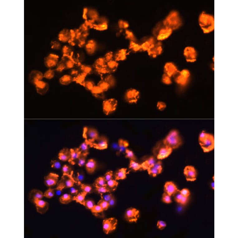 Immunofluorescence - Anti-PKC beta Antibody (A15012) - Antibodies.com
