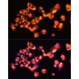 Immunofluorescence - Anti-PKC beta Antibody (A15012) - Antibodies.com