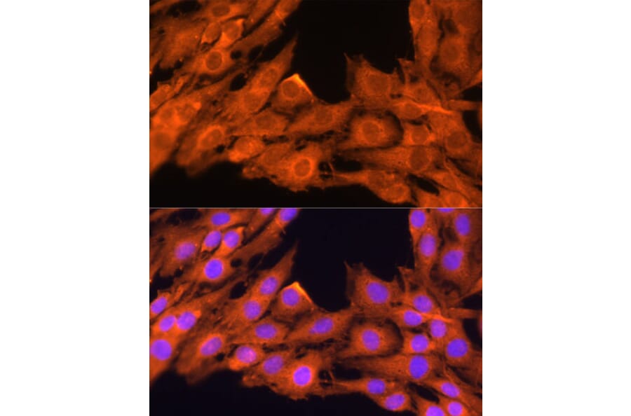 Immunofluorescence - Anti-PKC beta Antibody (A15012) - Antibodies.com