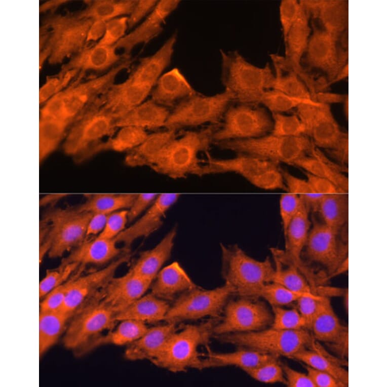 Immunofluorescence - Anti-PKC beta Antibody (A15012) - Antibodies.com