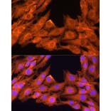 Immunofluorescence - Anti-PKC beta Antibody (A15012) - Antibodies.com