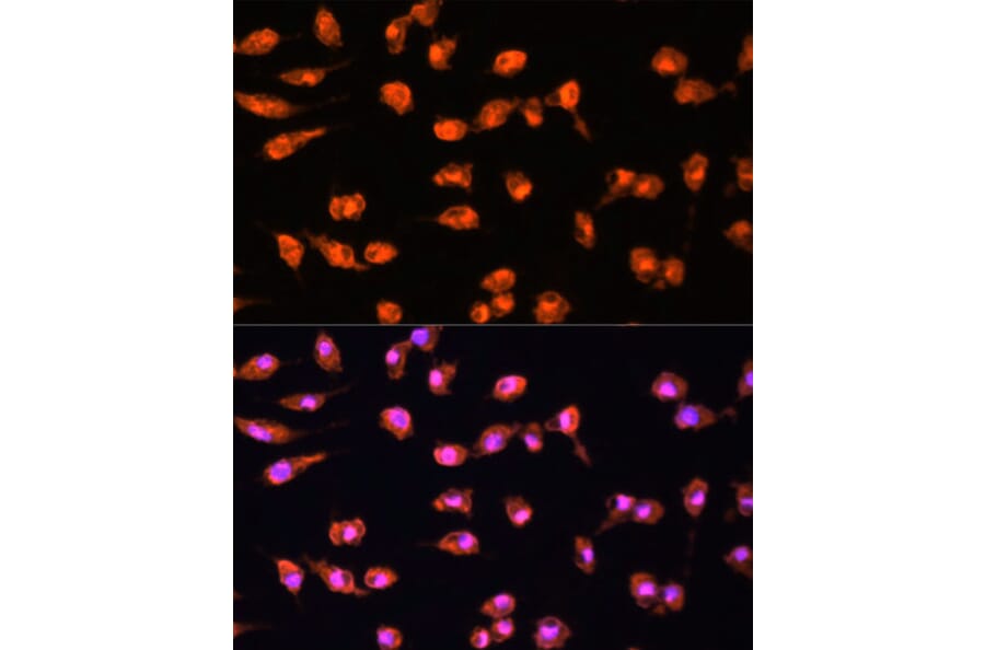 Immunofluorescence - Anti-PKC beta Antibody (A15012) - Antibodies.com