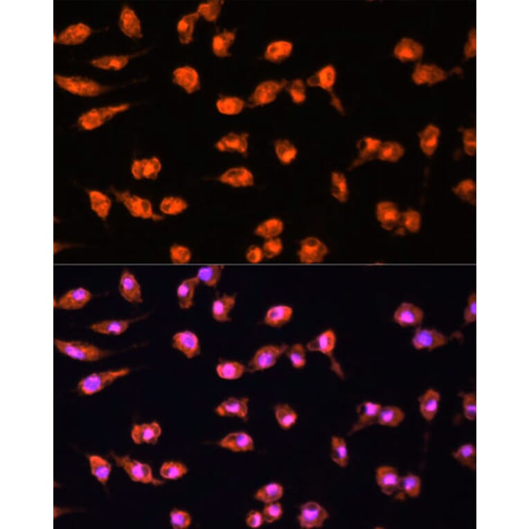 Immunofluorescence - Anti-PKC beta Antibody (A15012) - Antibodies.com