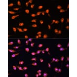 Immunofluorescence - Anti-PKC beta Antibody (A15012) - Antibodies.com