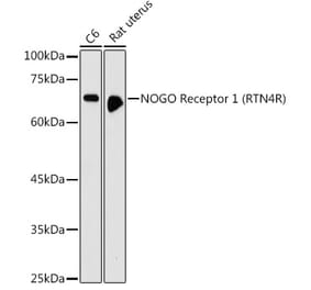 Western Blot - Anti-Nogo Receptor Antibody (A15013) - Antibodies.com