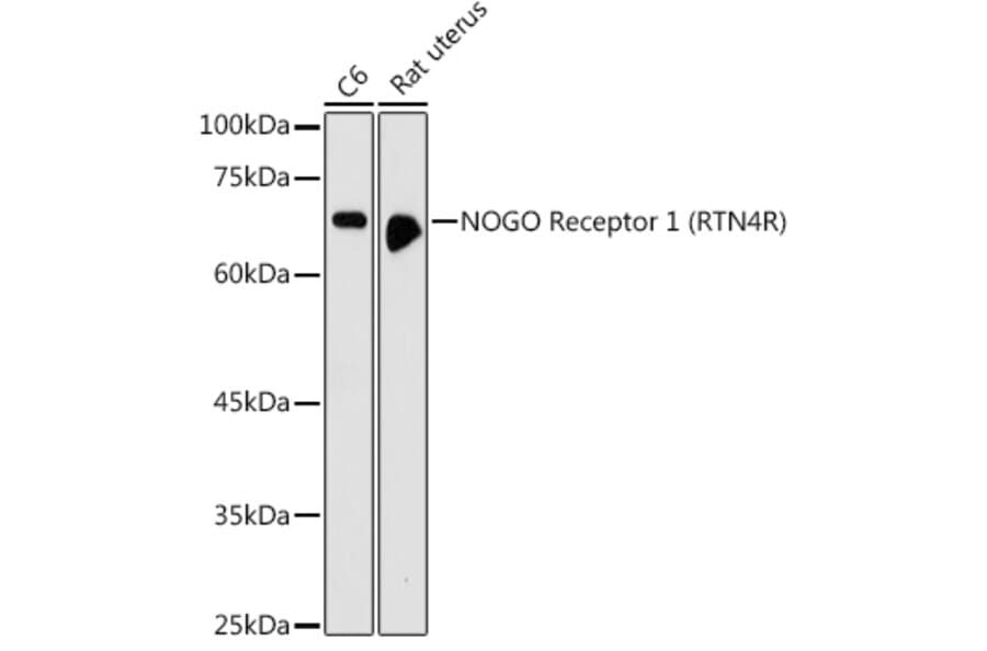 Western Blot - Anti-Nogo Receptor Antibody (A15013) - Antibodies.com