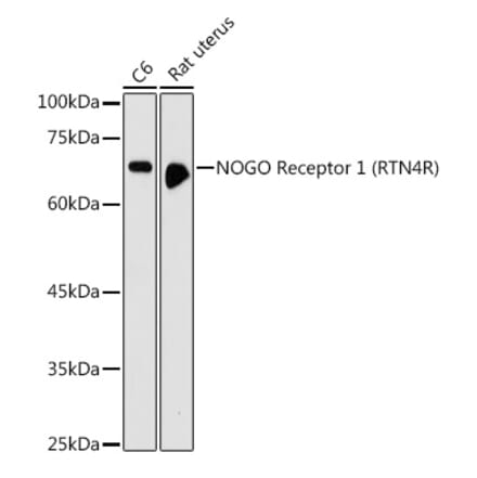 Western Blot - Anti-Nogo Receptor Antibody (A15013) - Antibodies.com