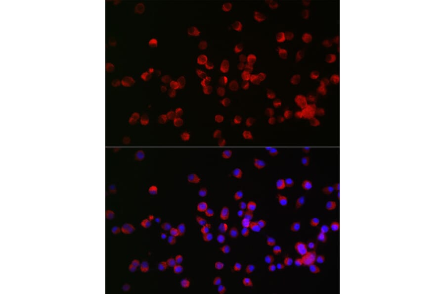 Immunofluorescence - Anti-Nogo Receptor Antibody (A15013) - Antibodies.com