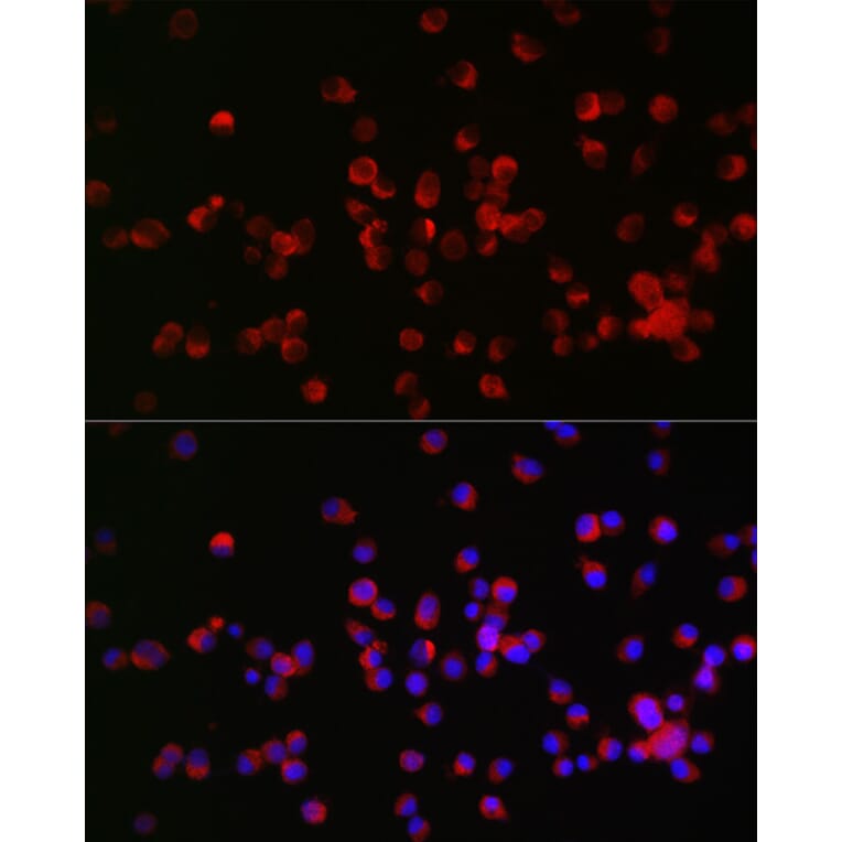 Immunofluorescence - Anti-Nogo Receptor Antibody (A15013) - Antibodies.com