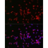 Immunofluorescence - Anti-Nogo Receptor Antibody (A15013) - Antibodies.com