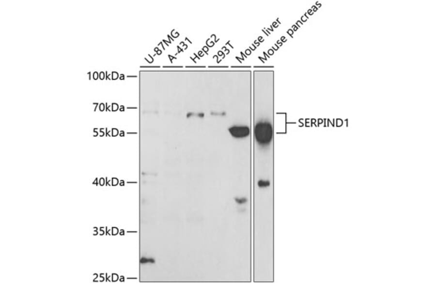 Western Blot - Anti-HC-II Antibody (A15014) - Antibodies.com