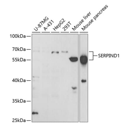 Western Blot - Anti-HC-II Antibody (A15014) - Antibodies.com