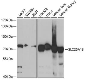 Western Blot - Anti-SLC25A13 Antibody (A5849) - Antibodies.com
