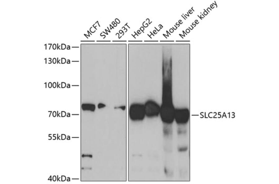 Western Blot - Anti-SLC25A13 Antibody (A5849) - Antibodies.com