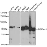 Western Blot - Anti-SLC25A13 Antibody (A5849) - Antibodies.com